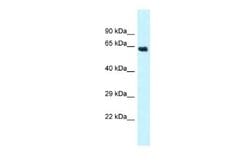 CYP4Z1 Rabbit anti-Human, Polyclonal, Novus Biologicals 0.1ml; Unconjugated:Antibodies,